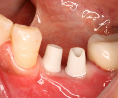 西本３　土台装着